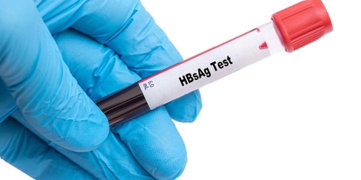 5 Tes Pemeriksaan Hepatitis B, Dari HBsAg Sampai USG