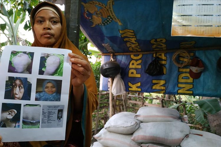 ibunda Sri Wahyuni, Nurasiah, Sabtu (27/7/2019) menunjukkan foto bekas penyiksaan yang dialami putrinya selama bekerja di Riyadh Arab Saudi, berharap Sri segera dipulangkan ke Lombok.