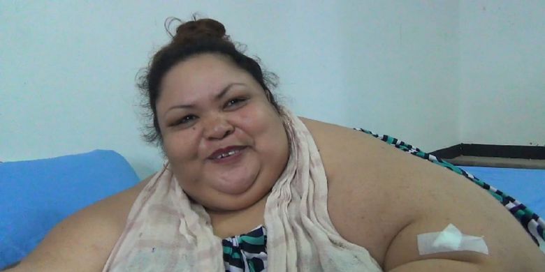 Wajah Titin, penderita obesitas 300 kg, terlihat mulai bisa tersenyum saat sudah berada diruang rawat inap rumah sakit di Palangkaraya, Jumat (11/1/2019). 