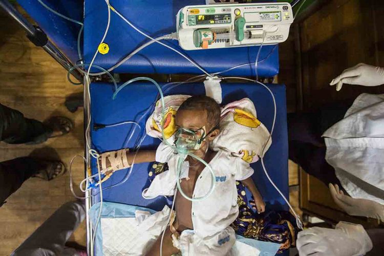 Dokter melakukan tindakan ke pasien Surfana (1 tahun) saat penanganan di Rumah Sakit Umum Daerah (RSUD) Agats, Kabupaten Asmat, Papua, Sabtu (27/1/2018). 