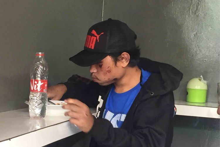 Seorang pemuda penderita epilepsi, Ali Achmat Fiarmansyah,(20) alias Iyan diduga dianiaya sejumlah petugas yang menjaga  Lapangan Banteng, Jakarta Pusat, Sabtu (18/8/2018). Iyan menderita luka lebam di wajah dan sudutan rokok di seluruh tubuh, Senin (20/8/2018).