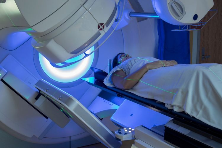 Ilustrasi terapi radiasi untuk penderita kanker payudara