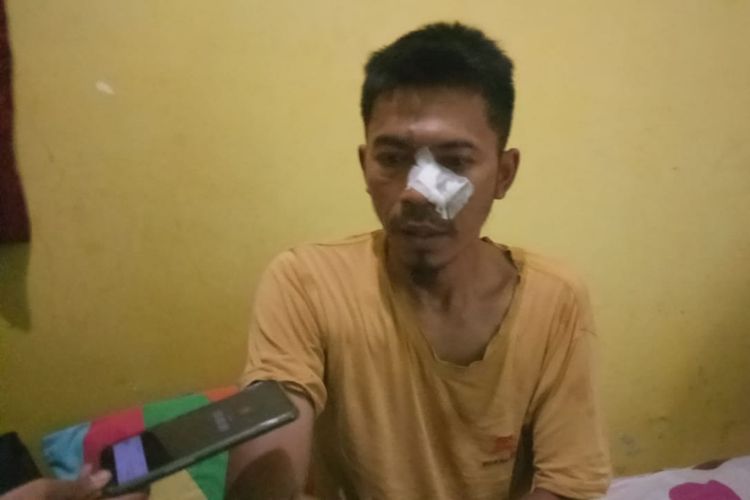 Agus (41) warga Villa Citra Bantarjati, Kota Bogor, saat ditemui di rumahnya, Senin (19/8/2019). Agus menjadi salah satu korban penganiayaan yang dilakukan puluhan oknum anggota Brimob saat perayaan 17 Agustus yang digelar di lingkungan tempat tinggalnya.