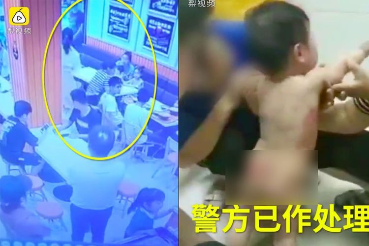 Potongan rekaman video menunjukkan seorang perempuan menyerang ibu dan bayinya ketika mereka bertengkar di restoran Xiangcheng, China. Foto kananketika ibu bayi itu menunjukkan luka bakar yang diderita anaknya setelah disiram dengan sup panas.