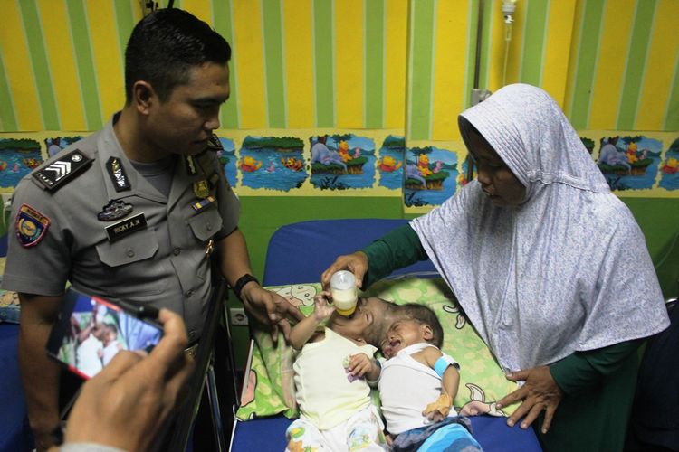Fadlan dan Fadli, 8 bulan, bayi kembar siam dempet kepala asa Cianjur, Jawa Barat tengah menjalani perawatan di IGD RSUD Sayang, Cianjur