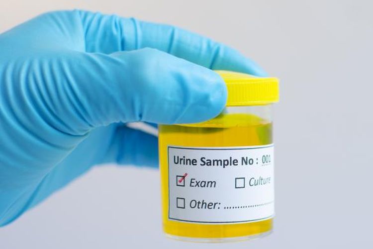 Ilustrasi tes urine