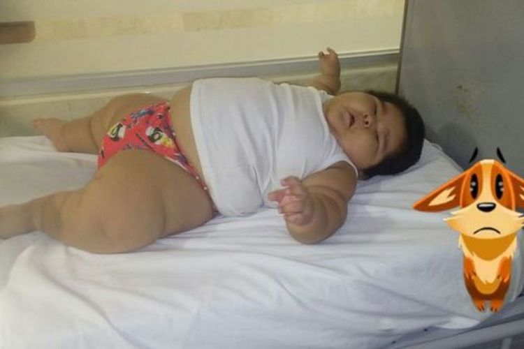 Luis Manuel (10 bulan) memiliki berat badan setara anak berusia sembilan tahun.