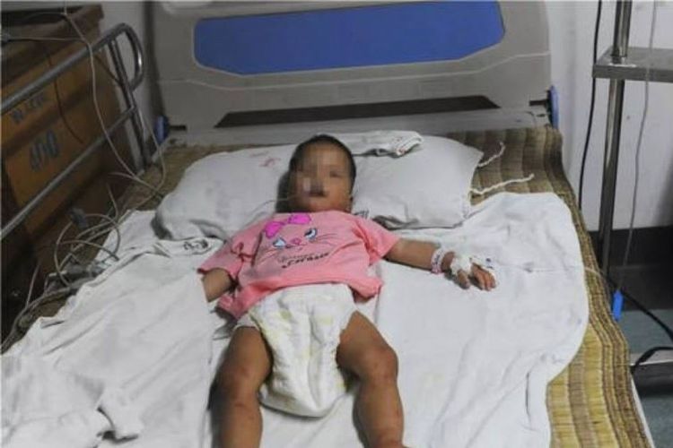Bayi perempuan berusia 22 bulan bernama Xiaojiao menjalani perawatan usai hilang selama empat hari di wilayah Guangxi, China. (SCMP)