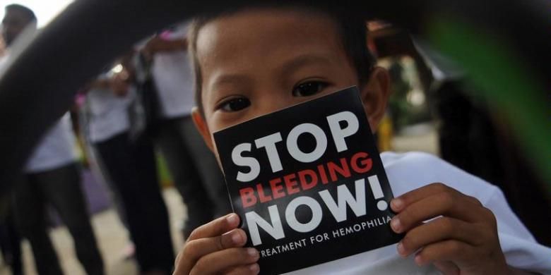 Penderita Hemofilia, Galang Madukara (5), menunjukkan stiker yang akan dibagikannya saat Aksi Damai Peringatan Hari Hemofilia Sedunia di RSUD dr Soetomo, Surabaya, Jawa Timur, Rabu (17/4/2013). Selain bentuk terimakasih kepada tenaga medis, Aksi yang diselenggarakan oleh Himpunan Masyarakat Hemophilia (HMHI) Jawa Timur tersebut merupakan sosialisi mengenai penyakit dan meminta kepada masyarakat untuk menciptakan kondisi yang mendukung  bagi penderita.
