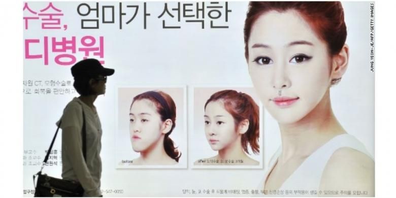 Iklan operasi plastik di Korea Selatan