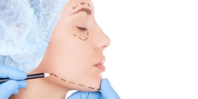 ilustrasi operasi plastik di bagian wajah.