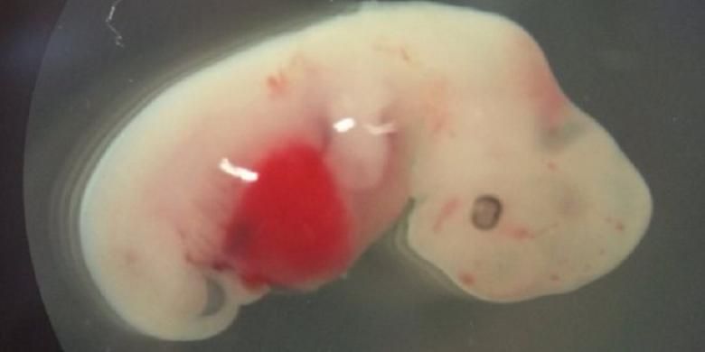 Embrio babi manusia