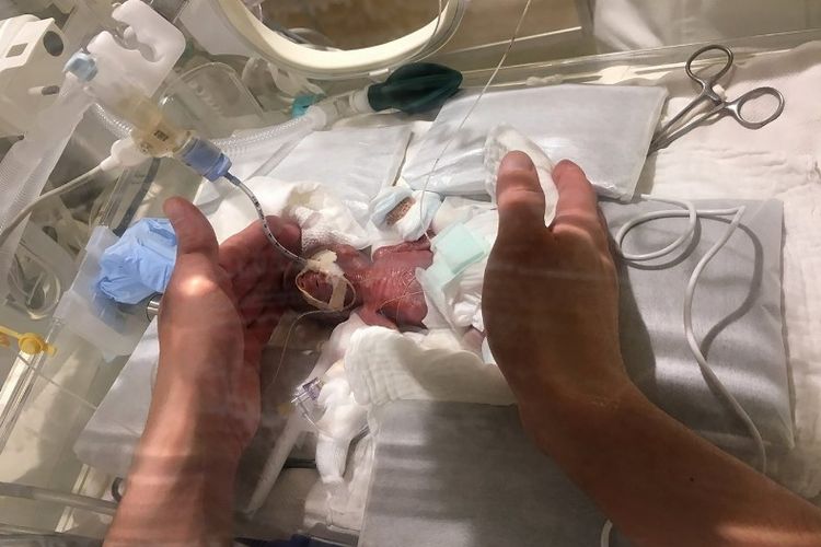 Keio University Hospital di Jepang memperlihatkan bayi berusia lima hari, yang beratnya 268 gram saat dilahirkan. Foto ini dirilis pada 27 Februari 2019. (AFP/Keio University Hospital)