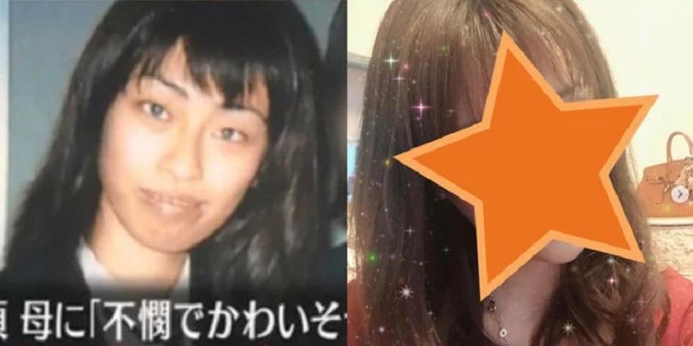 Model Jepang Tsubaki Tomomi mengaku menjalani operasi plastik setelah diejek ibunya saat kecil.