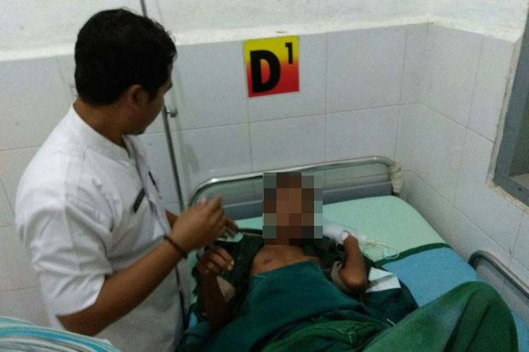 JS, remaja 14 tahun, dibakar temannya pasca-operasi di RSUD Genteng, Rabu (9/8/2017).
