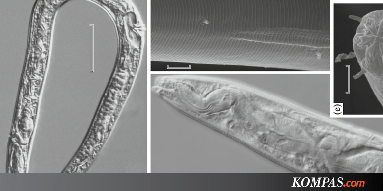 Membeku 42.000 Tahun, Cacing Ini Berhasil Dihidupkan Kembali