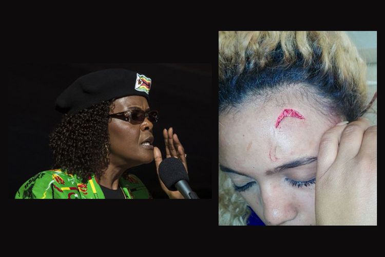 Ibu Negara Zimbabwe Grace Mugabe (kiri) dan perempuan model Gabriella Engels dengan luka terbuka di dahinya. 