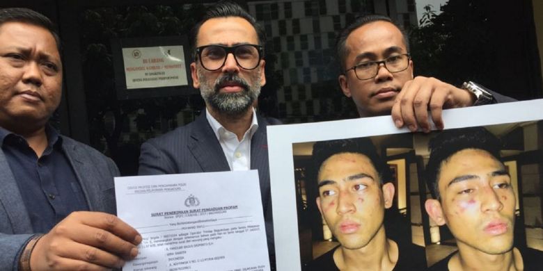 Jeremy Thomas didampingi tim kuasa hukumnya berjumpa dengan para wartawan sesudah mereka melaporkan delapan oknum polisi yang diduga pelaku penganiayaan terhadap putranya, Axel Matthew Thomas, ke Sentra Pelayanan Propam Polri, Jakarta Selatan, pada Senin (17/7/2017).