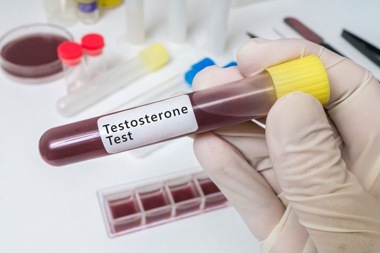 Hand holds test tube for testosterone test.