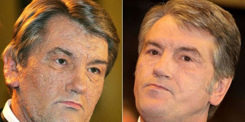 Mantan Presiden Ukraina periode 2005-2010 Viktor Yushchenko. Foto kiri adalah penampilan Yushchenko di 2005 setelah dia pulih dari usaha peracunan terhadap dirinya pada 2004. Kanan adalah penampilan Yushchenko saat 2015.
