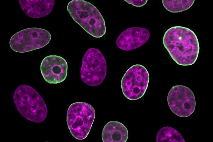 Nukleus dari sel manusia dengan membran yang diwarnai hijau