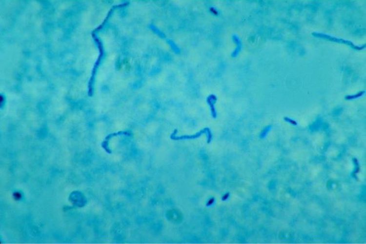 Fusobacterium necrophorum, sejenis bakteri penyebab sindrom Lemierre, infeksi langka yang dijuluki sebagai penyakit yang terlupakan.