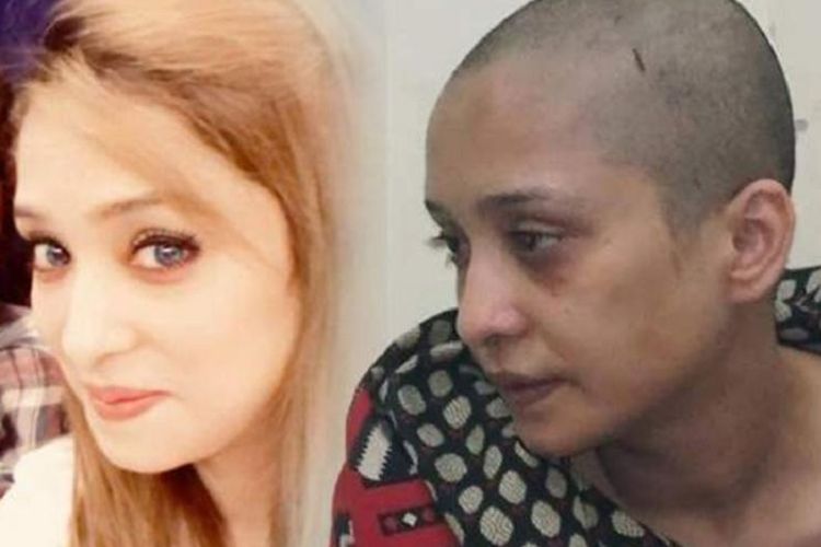Asma Aziz korban KDRT di Pakistan mengunggah fotonya sebelum dan sesudah disiksa sang suami.