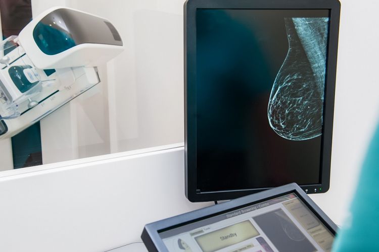 Ilustrasi mamografi