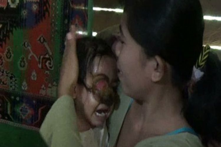 Almarhum bocah Zalzakiyah (2,5 tahun) asal Polewali Mandar, Sulawesi Barat, yang menderita tumor ganas di mata kanannya saat digendong ibunya, Musdalifah, beberapa waktu lalu. 