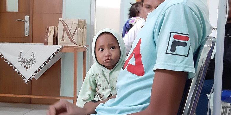 Seorang balita di NTT penderita bibir sumbing tengah menjalani proses pengobatan di St. Carolus Borromeus Kupang