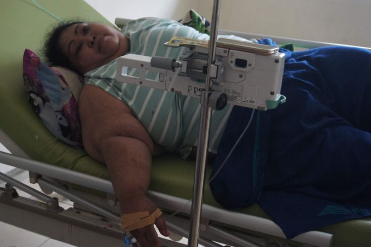 Sunarti (39), penderita obesitas tengah menjalani perawatan di RSUD Karawang, Kamis (31/1/2019).

