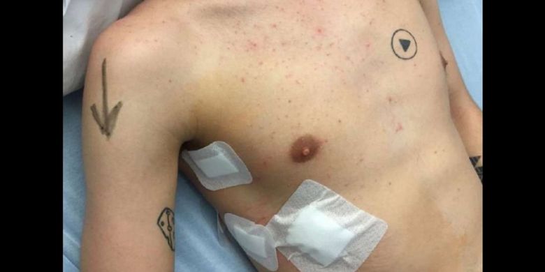Mans play button tattoo almost creates huge surgery mishap

METRO GRAB taken from: http://casereports.bmj.com/content/2018/bcr-2017-223704.full.pdf

Credit: BMJ Case Reports