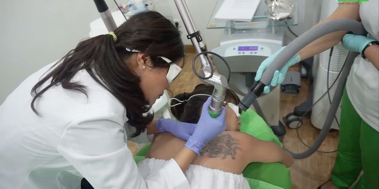 Menghapus tato dengan sinar laser di ZAP Beauty Clinic.