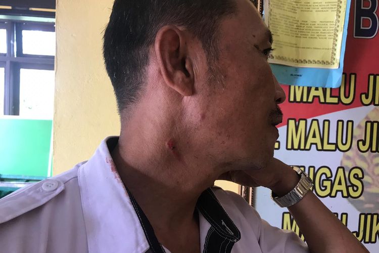 Kepala Sekolah SMA Negeri 2 Rakit Kulim, Inhu, Riau, Bambang Fajrianto (50) memperlihatkan luka dibagian leher akibat dianiaya siswanya berinisial A, Rabu (13/3/2019). Dok. Polres Inhu 