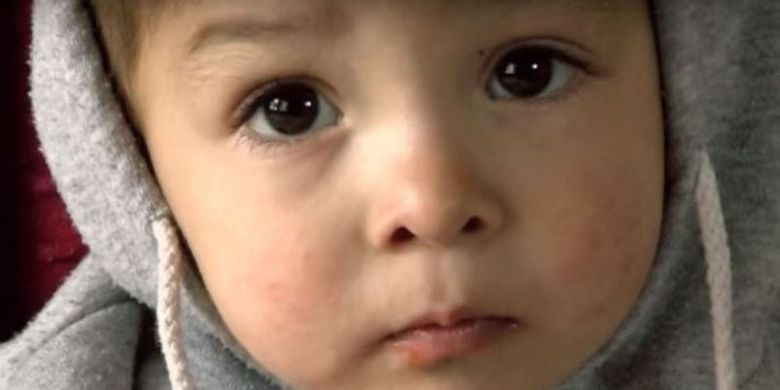 Inilah Donald Trump, bayi berusia 18 bulan yang berasal dari Afghanistan. Namanya terinspirasi dari Presiden ke-45 Amerika Serikat.
