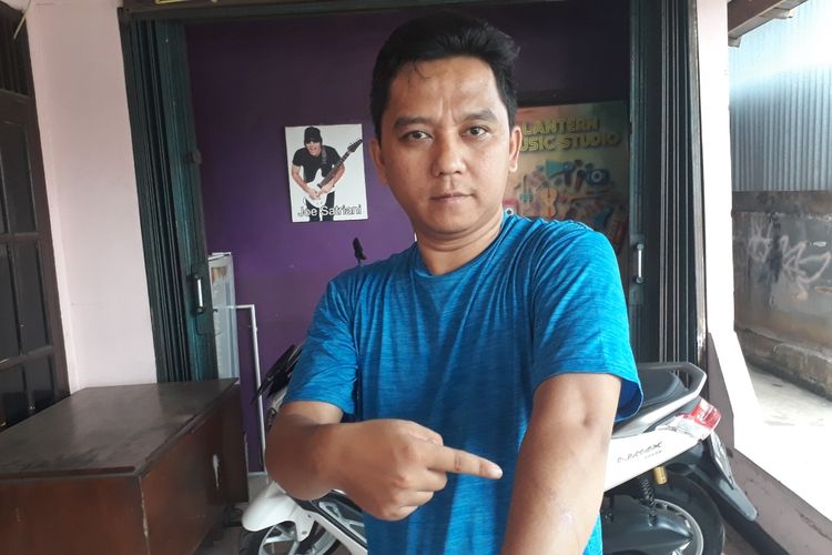 Salahudin (36), adik penjual pecel lele di Jalan Raya Jatimakmur, Pondok Gede, Kota Bekasi yang dikeroyok pembelinya lantaran merasa menunggu lama pesanan, Rabu (20/3/2019).