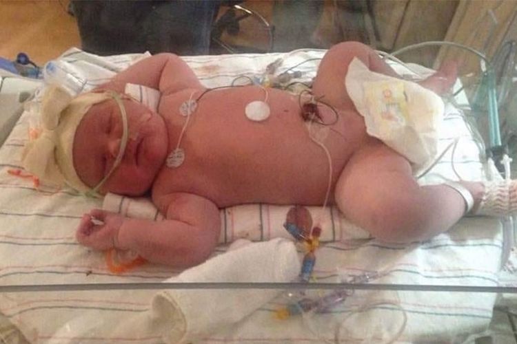 Bayi perempuan bernama Harper Buckley ini lahir dengan bobot hampir 7 kilogram dan panjang 60 sentimeter, pada Senin (11/3/2019).