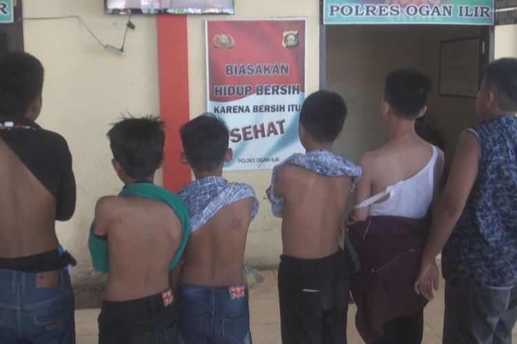 Keenam siswa membuka baju untuk menunjukkan luka lebam di punggung dan lengan mereka setelah dipukul oknum penjaga sekolah di sekolah mereka SMP Negeri 2 Tanjung Batu