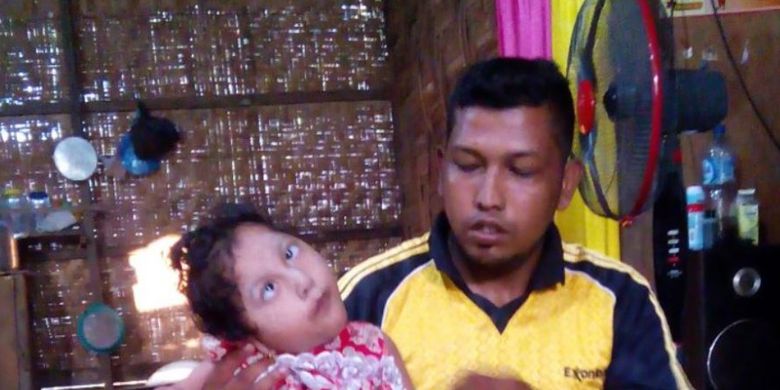 Farazil (6) digendong ayahnya, Muhammad Ali, di rumahnya di Desa Matang Tunong, Kecamatan Lapang, Kabupaten Aceh Utara, Selasa (20/3/2018).