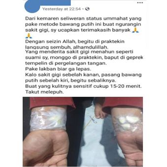 Tangkapan layar yang menyebutkan bahwa menempelkan bawang putih di pergelangan tangan dapat menyembuhkan sakit gigi.