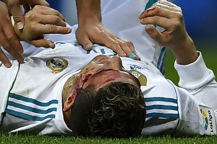 Penyerang Real Madrid, Cristiano Ronaldo, terbaring di lapangan pertandingan dalam keadaan terluka setelah mencetak gol keduanya ke gawang Deportivo La Coruna dalam pertandingan La Liga Spanyol 2017-2018 di Stadion Santiago Bernabeu, Madrid, Spanyol, pada Minggu (21/1/2018).
