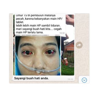 Viral Foto Mata  Merah karena Pembuluh Pecah akibat Main 