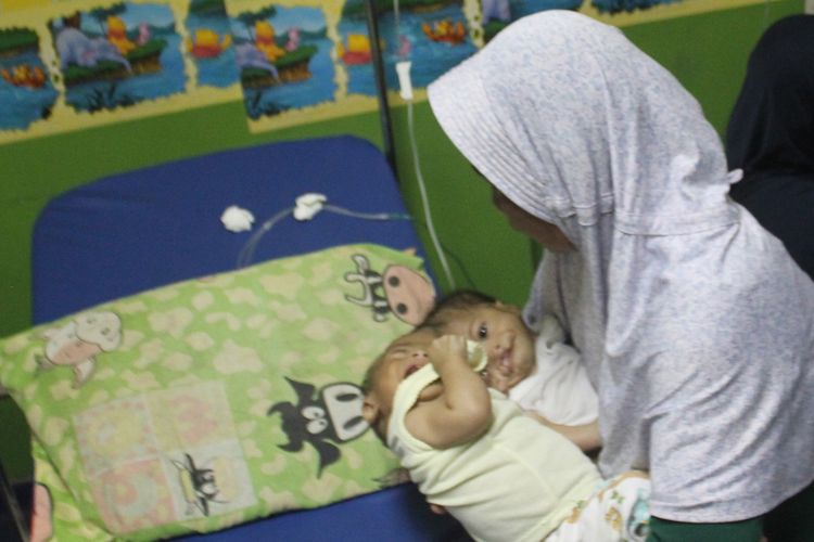 Fadlan dan Fadli, 8 bulan, bayi kembar siam dempet kepala asal Cianjur, Jawa Barat tengah menjalani perawatan di IGD RSUD Sayang, Cianjur