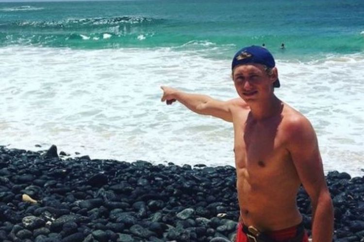 Dylan McWilliams (20) baru saja mendapat serangan hiu saat tengah berselancar di Hawaii.