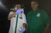 Cacing Pita Sepanjang 10,5 Meter Ditemukan di Simalungun