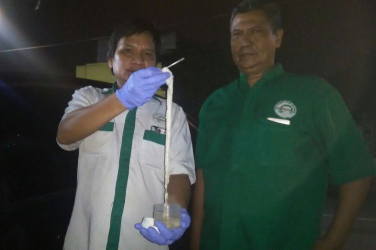 Cacing pita ditunjukkan tim Fakultas Kedokteran UISU Medan didampingi dr Umar Zein, Senin (26/3/2018).