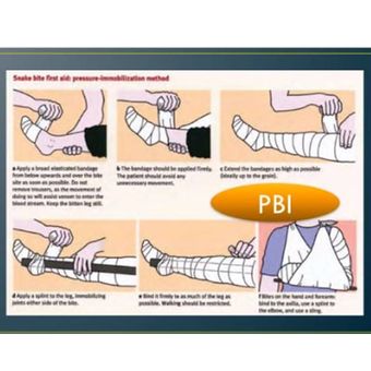 Pressure Bandage Immobilization.