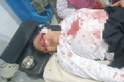 Wanita Ini Dipukul Pakai Kayu hingga Terluka Parah saat Mengendarai Motor