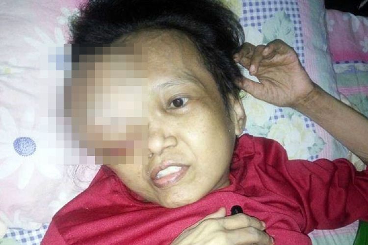 Nuriyatmi Usia (47), warga Desa Bale Kecamatan Oba, Kota Tidore Kepulauan, Maluku Utara hanya bisa terbaring akibat penyakit kanker yang dideritanya, Minggu (3/2/2019).