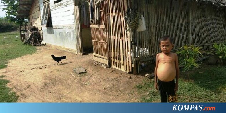 Perjuangan Ibnu, Bocah 11 Tahun Melawan Kanker Ini